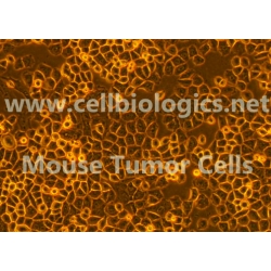 Mouse Tumor Epithelial Cells (Hu. Pancreatic Cancer Origin, Bx-PC3 GFP) 